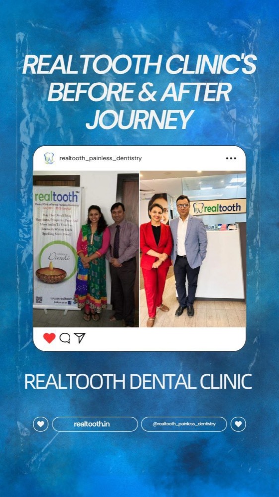 Smile Transformations — RealTooth reel