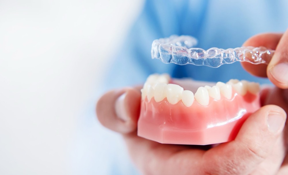 Invisible clear aligners in Lucknow