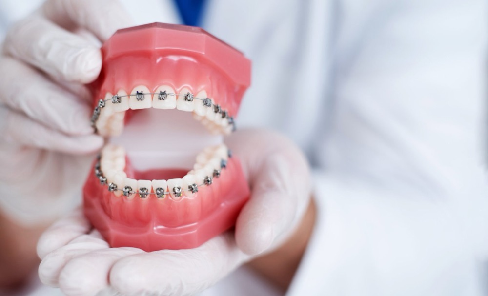 Orthodontic assessment at RealTooth